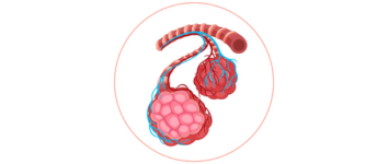 Carotid Stenting